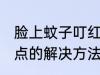脸上蚊子叮红点怎么办 脸上蚊子叮红点的解决方法