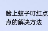 脸上蚊子叮红点怎么办 脸上蚊子叮红点的解决方法