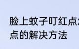 脸上蚊子叮红点怎么办 脸上蚊子叮红点的解决方法