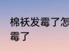 棉袄发霉了怎么洗掉 如何解决棉袄发霉了